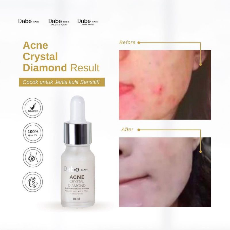 DABE BEAUTE SKINCARE SERUM ACNE