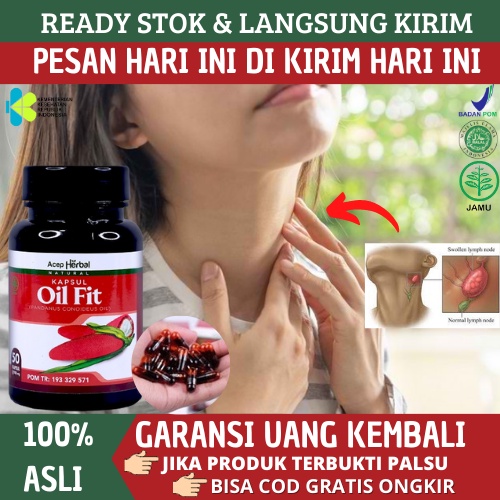 Obat Kelenjar Getah Bening Benjolan Di Leher Untuk Anak Dan Dewasa, Obat Kelenjar Tiroid, Obat Gondo