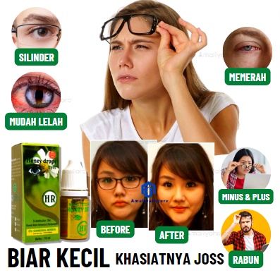 Honey Drops Eyes Vitamin Mata Anak Dan Dewasa Obat Mata Minus Rabun Jauh Mata Bengkak Merah Berlemak Silnder Cendo Paling Ampuh Noni Eye Obat Tetes Mata Herbal Tanpa Operasi Original