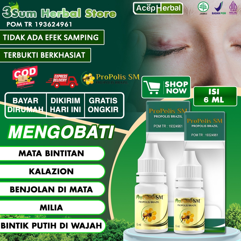 Jual Obat Kalazion Di Kelopak Mata Bintitan Di Dalam Dan Luar Mata Bengkak TImbilan Milia Di