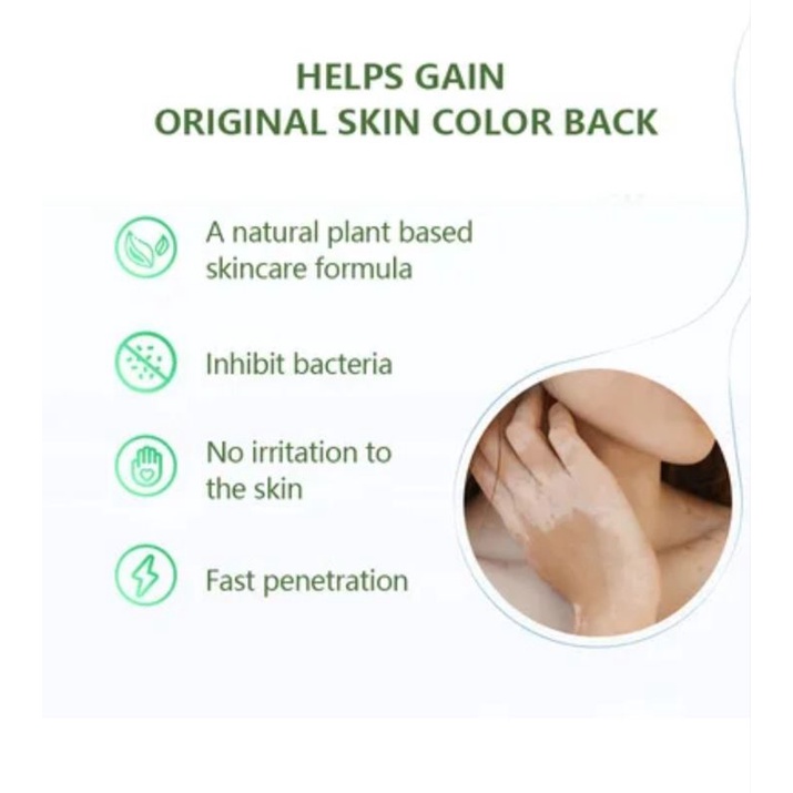 Salep Cream Vitiligo 20 gram Herbal Aman, Salep Cream Belang Herbal Aman, Salep Cream Bercak Herbal Aman
