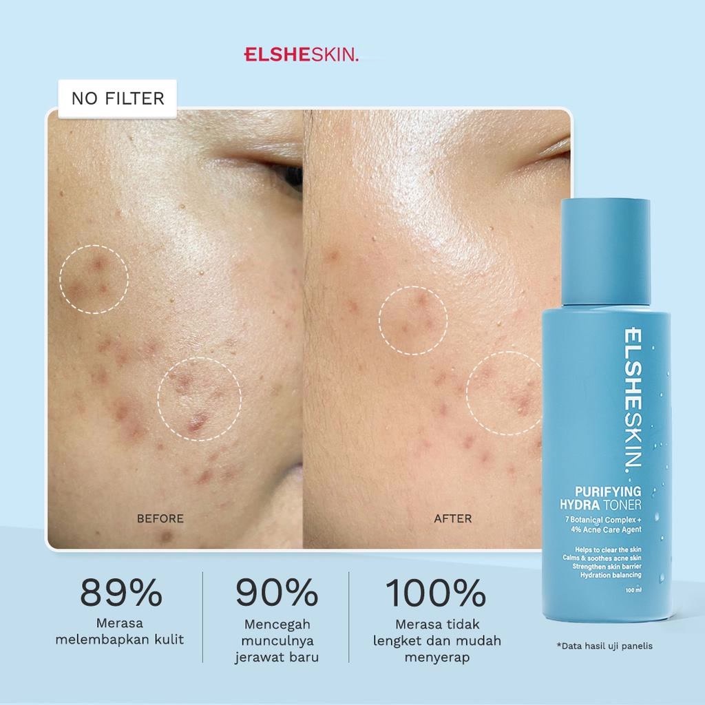 ★ BB ★ ElsheSkin Purifying Hydra Toner 100ml - Hydrating Skincare Berminyak dan Berjerawat (Acne, Bekas Jerawat &amp; Glowing)