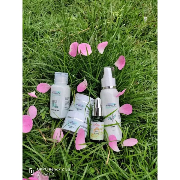 HY_PRM LUXURY ACNE GLOW (jerawat ringan, jerawat parah)