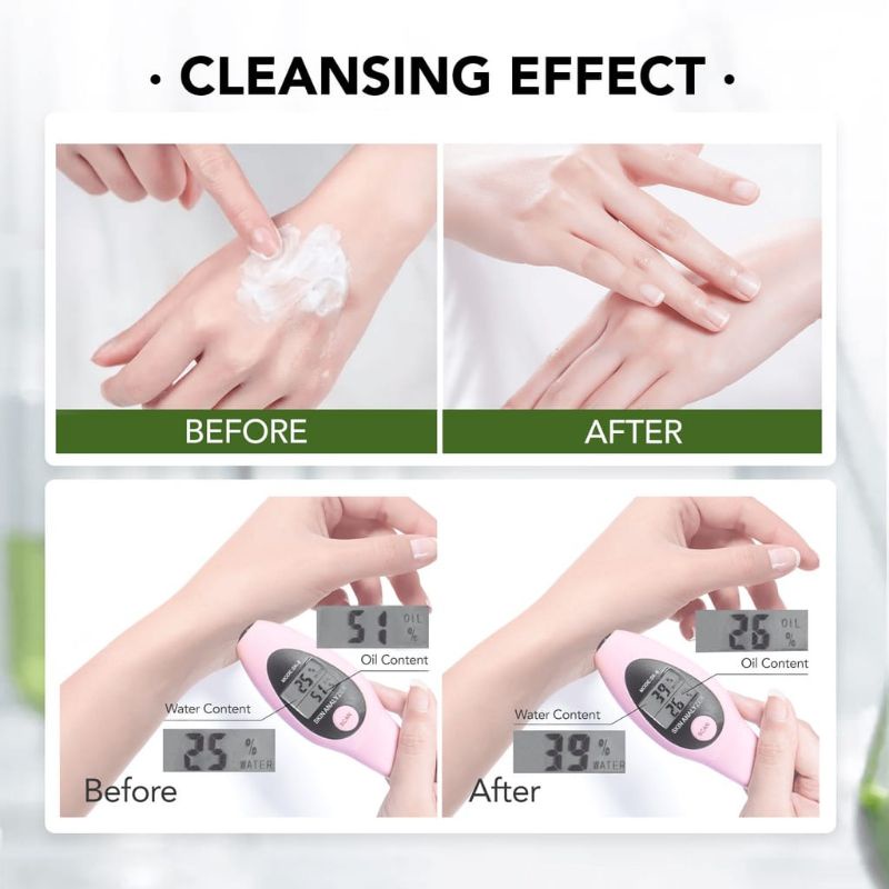 YOU AcnePlus Low pH Calming Cleanser