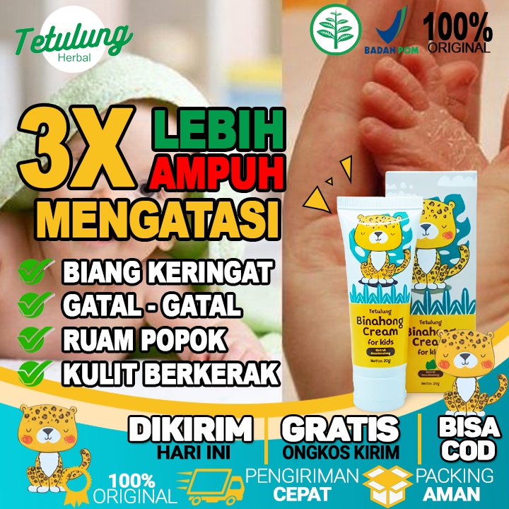 Obat Salep Biang Keringat Paling Ampuh Dan Mengurangi Gatal Gatal Pada Bayi