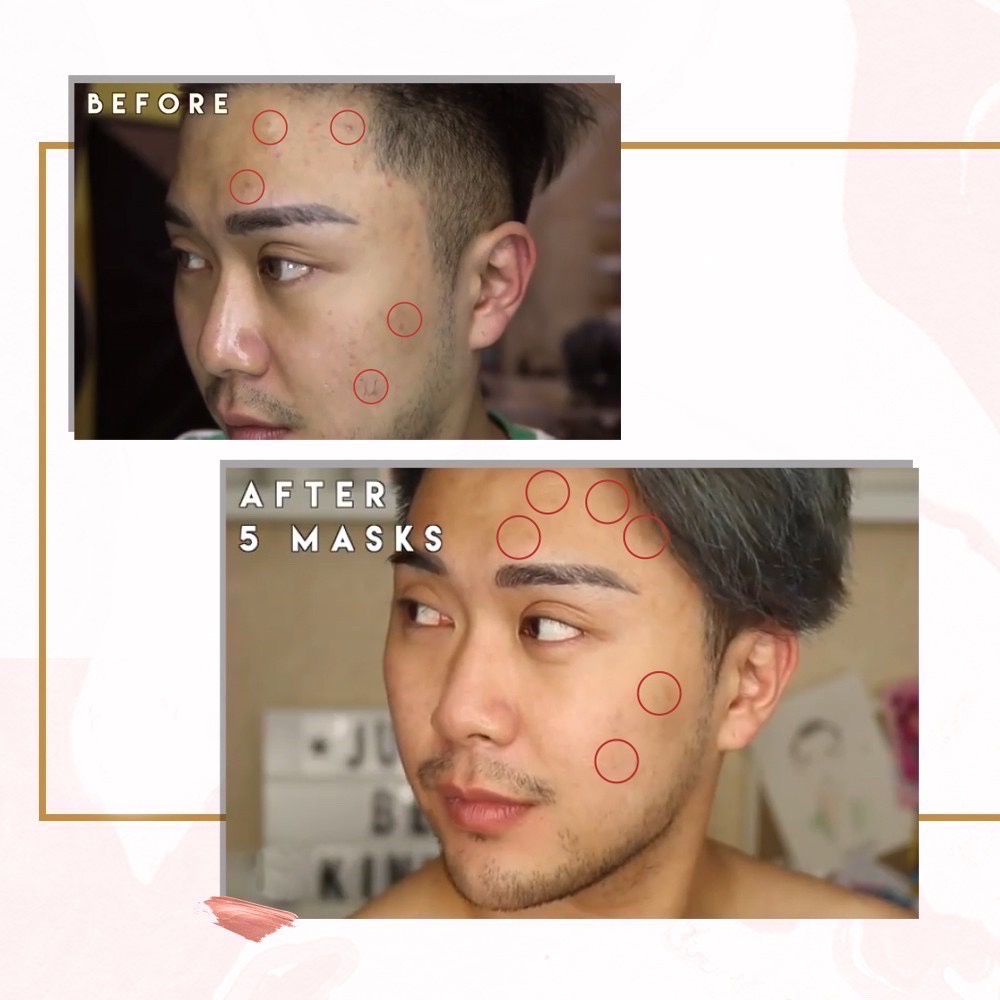 DR SCHATZ SCHAT SCHATS MCC Masker Wajah BPOM Original Mask | Polypeptide Collagen Mask | Stem Cell Mask 1EA / Box Eceran Pcs