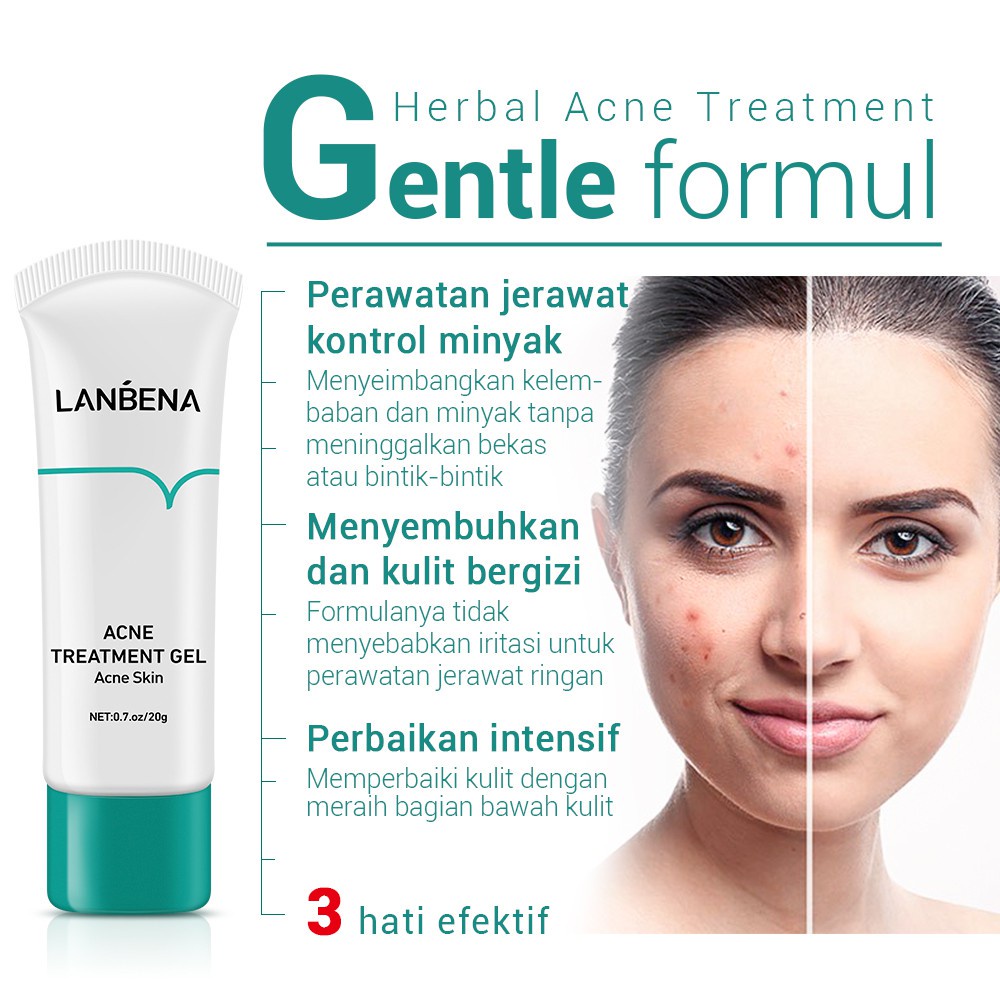 [BPOM] LANBENA Gel Treatment - Wajah Berjerawat (20 g)