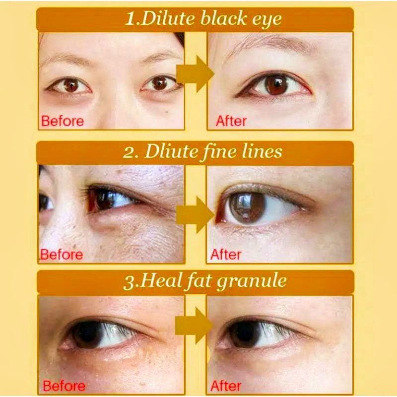 MASKER MATA COLLAGEN KOLAGEN - MENGHILANGKAN MATA PANDA KERUTAN GARIS HITAM DLL