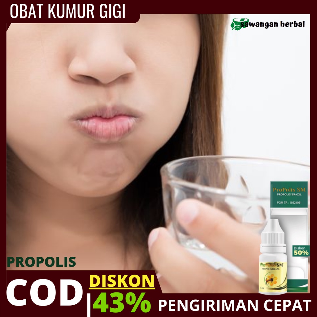 Propolis SM Herbal Obat Sakit Gigi - obat Gusi Bengkak Paling  Untuk anak dan Dewasa n cataflam, Oba