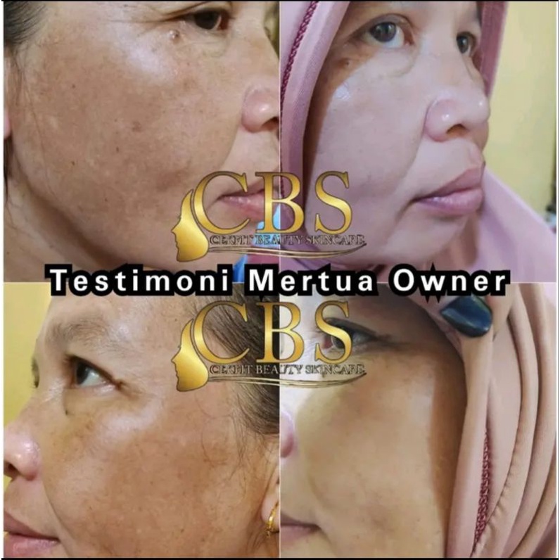 BPOM PAKET CBS CEKFIT BEAUTY SKINCARE JERAWAT DAN FLEK SABUN TONER CREAM