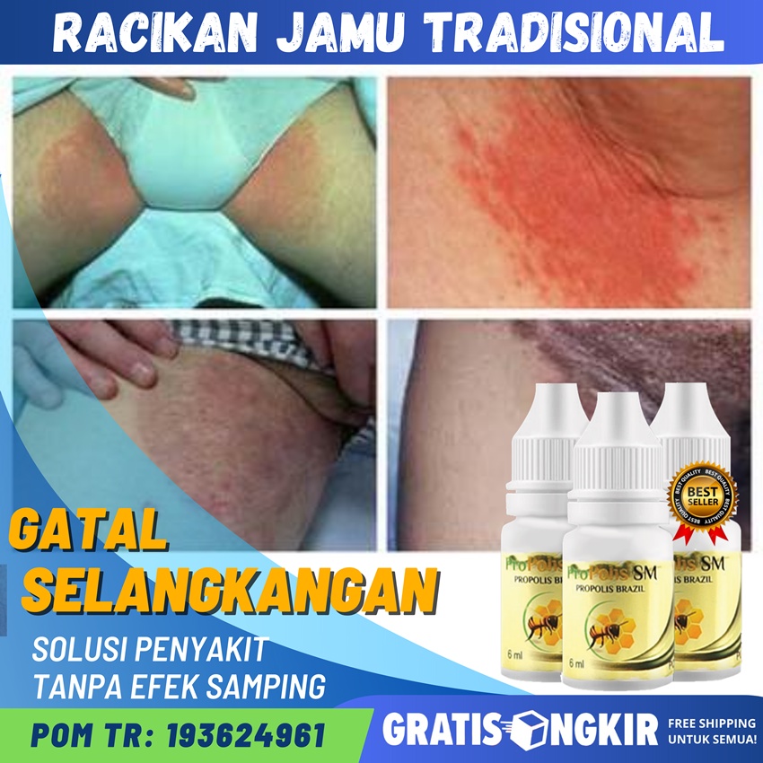 Jual Obat Gatal Selangkangan Eksim Jamur Panu Obat Selangkangan Gatal