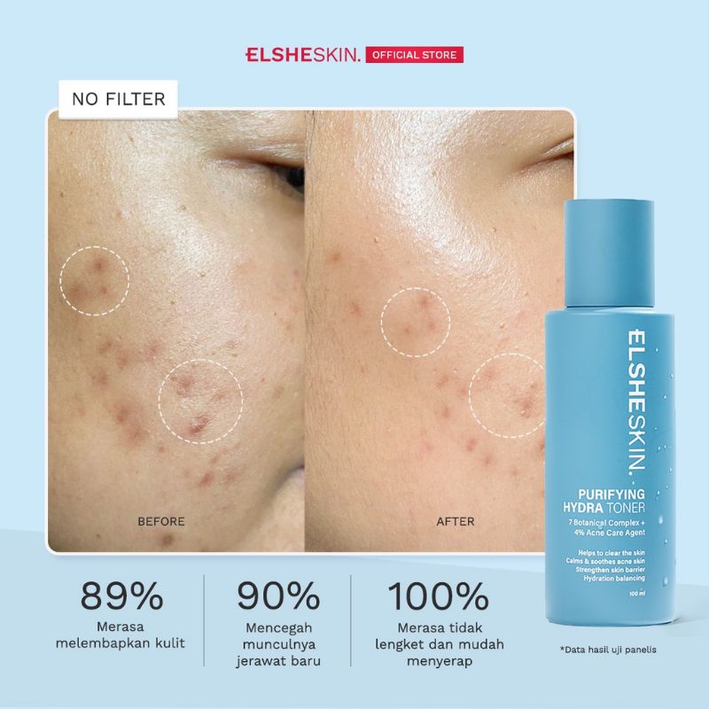 (GOSEND/COD) ELSHESKIN PURIFYING HYDRA TONER 100ML - HYDRATING TONER UNTUK KULIT BERMINYAK DAN BERJERAWAT