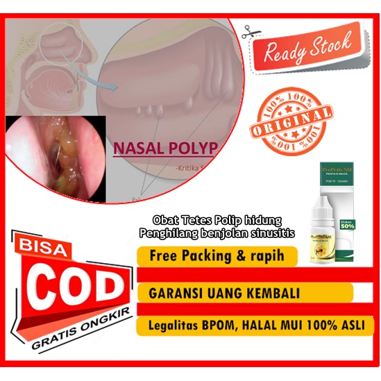 PROPOLIS SM - Obat Tetes Polip hidung, Penghilang benjolan sinusitis, Menghilangkan benjolan Polip h