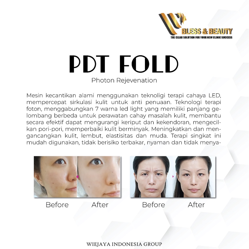 PDT LIGHT OMEGA 7 WARNA PHOTODYNAMIC THERAPY TREATMENT FOLD LED TERBARU