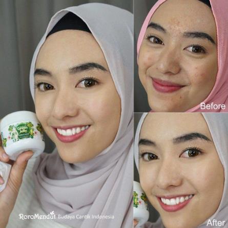 ^ KYRA ^ Roro Mendut Green Jelly Red Orange Glowing Skincare Booster Day And Night Treatment