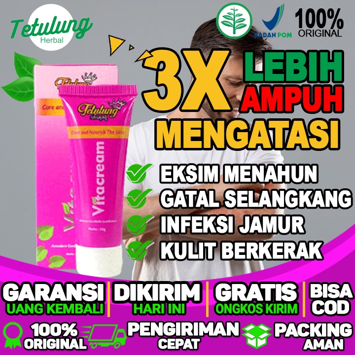 Obat Salep Penghilang Gatal Kurap,Panu,Eksim Kering Dan Eksim Basah Pada Kulit