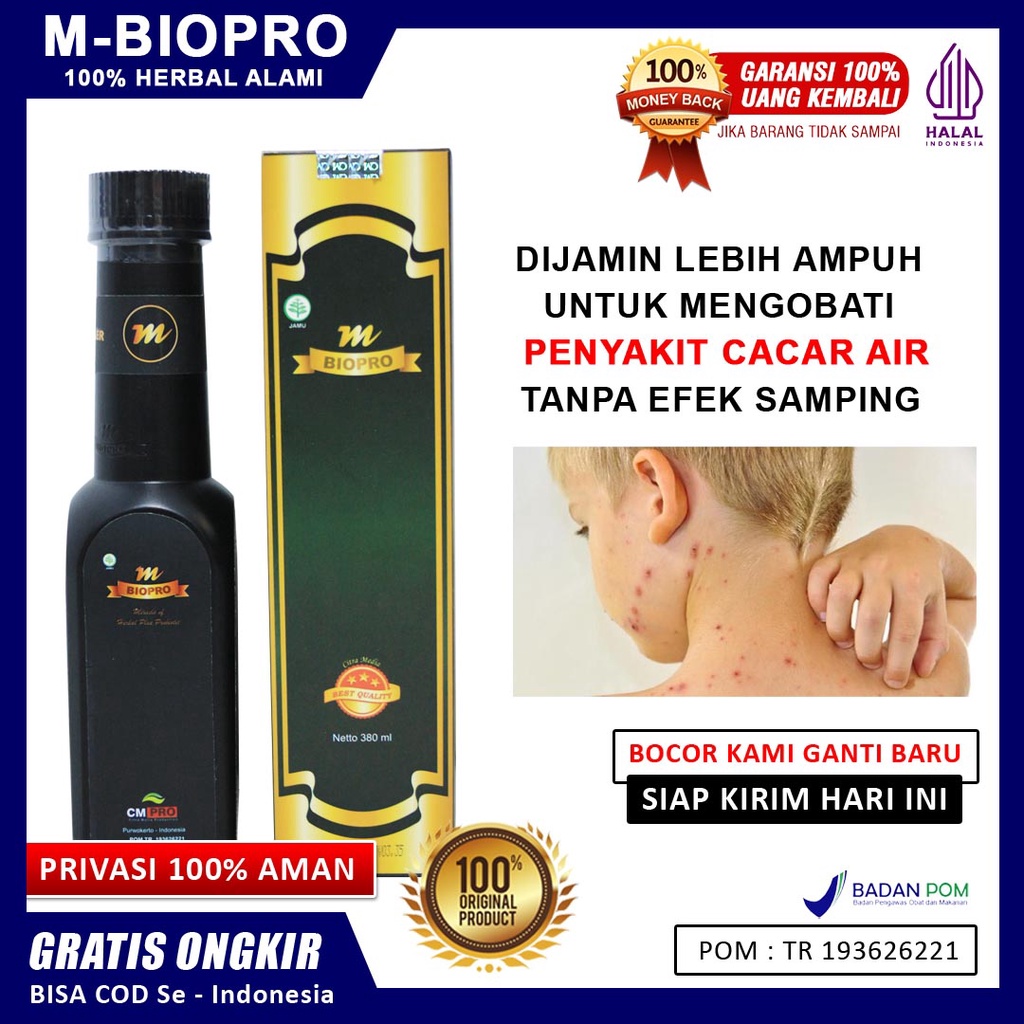 Obat cacar air paling ampuh - cacar air untuk anak - dewasa - cacar monyet - cacar tanaman cabe - ca