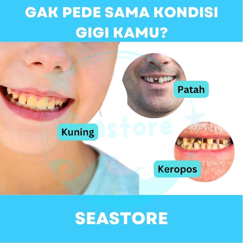 Veneer Vener Gigi Snap On Smile Authentic Perawatan Kesehatan Gigi Palsu Renggang Snapon Smile 1 Set 100% ORI