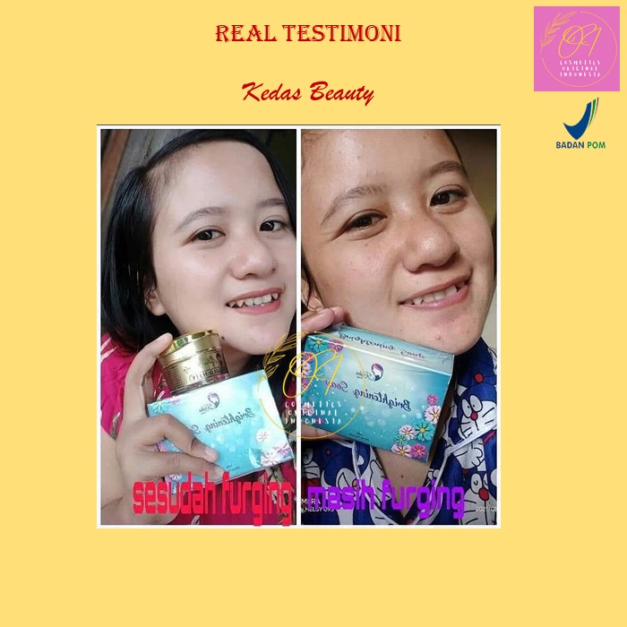 Kedas Beauty Original100% Body Serum Pemutih Pencerah Wajah &amp; Badan BPOM Halal