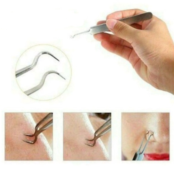 PA Pinset Jepit Komedo Stainless Steel Blackhead Tweezer / Alat Capit Untuk Menghilangkan Komedo / Penjepit PR121