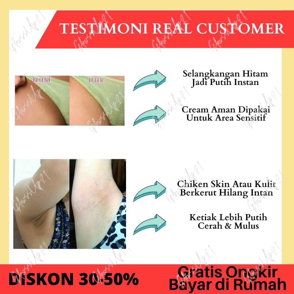 CREAM PENCERAH KETIAK SHINKURIM - PEMUTIH SELANGKANGAN - PEMUTIH BADAN PERMANEN PERAWATAN TUBUH
