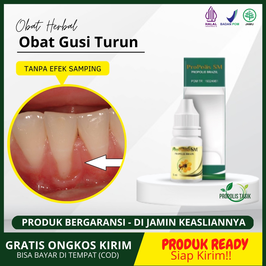 Obat Gusi Turun Gingiva Gusi Turun / Menyusut, Akar Gigi Telihat, Nyeri Garis Gusi, Gusi Berdarah Me