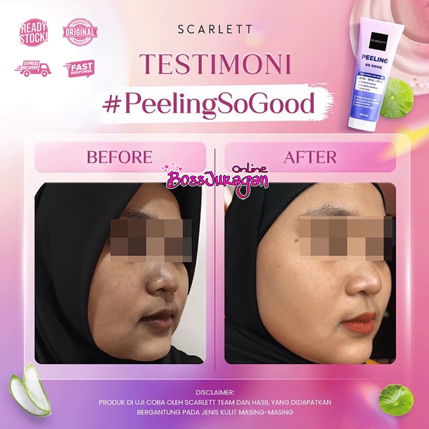 (BOSS) Scarlett Whitening Peeling So Good | Brightening Peeling Gel 100ml BPOM Original by Felicya Angelista