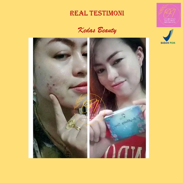 Kedas Beauty Original100% Body Serum Pemutih Pencerah Wajah &amp; Badan BPOM Halal