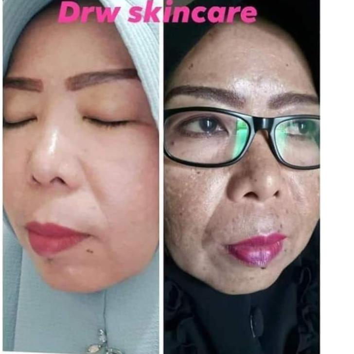 Paket Hemat Brightening Flek Tebal /Acne Jerawat/ Drw Skincare cream pemutih wajah racikan dokter penghilang flek