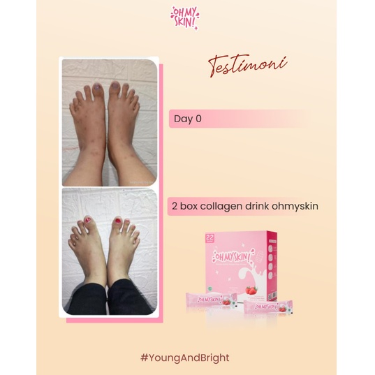 OH MY SKIN ! Collagen Drink Minuman Collagen Pemutih Badan Dan Glowing