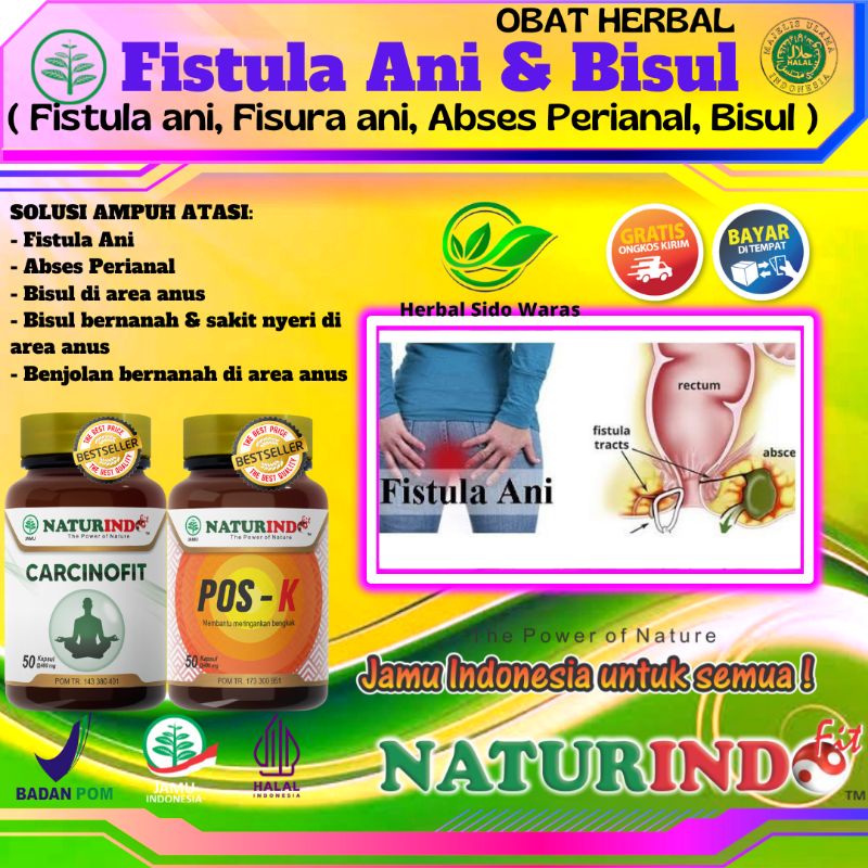 Obat Fistula Fisura Ani Obat Bisul Di Pantat Obat Bisul  Herbal Ampuh Vistula Fistula Radang Abses A