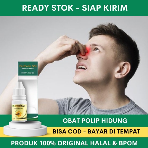 Obat Polip Hidung, Obat Polip Hidung Bengkak, Obat Polip Benjolan di Hidung, Obat Penyakit Polip Hid