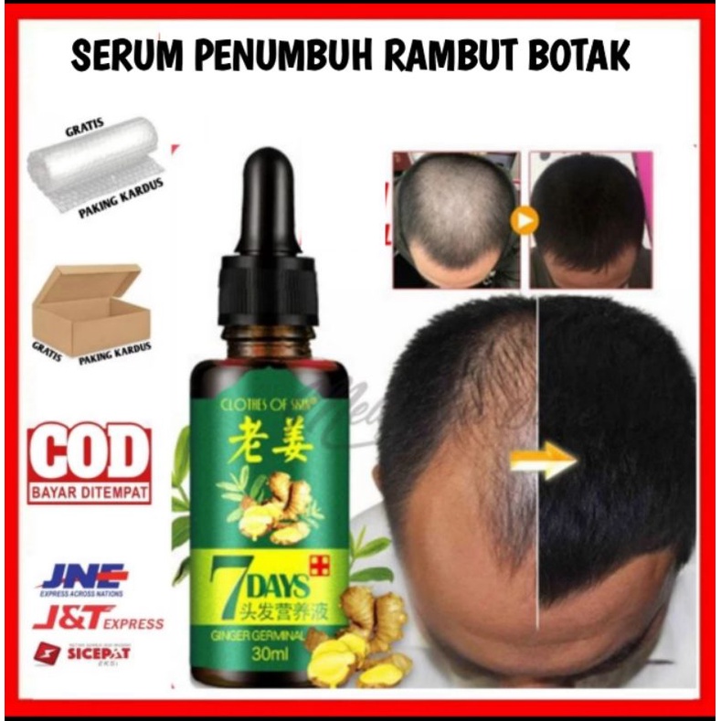 SERUM PENUMBUH RAMBUT BOTAK