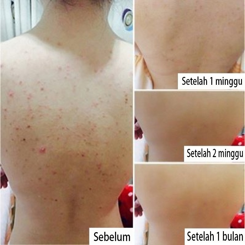 Sabun pemutih Sabun pemutih badan permanen Sabun jerawat Sabun mandi pemutih Badan body wash whitening Komposisi garam laut alami 500ML Mencerahkan Kulit / Menghilangkan Luka / Pengangkatan Kulit Mati