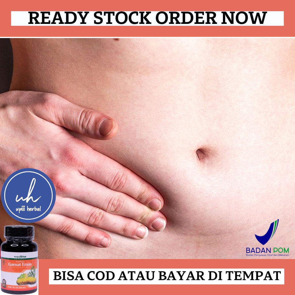 Obat Hernia Turun Berok, Obat Untuk Hernia, Obat Turun Berok, Obat Hernia, Obat Hernia Inguinalis, O