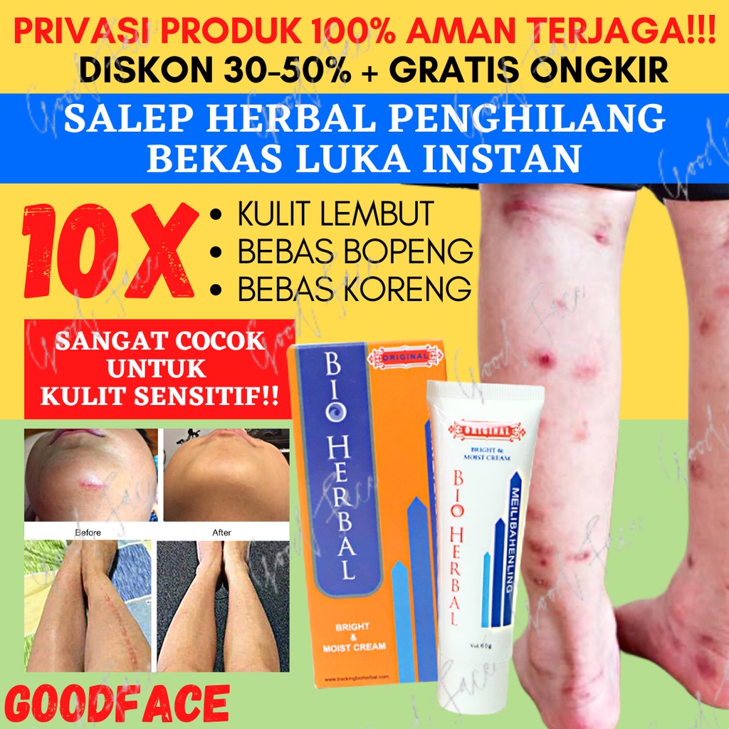 PENGHILANG BEKAS LUKA MEILIBAHENLING SALEP KORENG DAN BEKAS BIO HERBAL