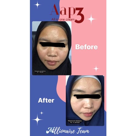 AAP3 CREAM ALL IN ONE