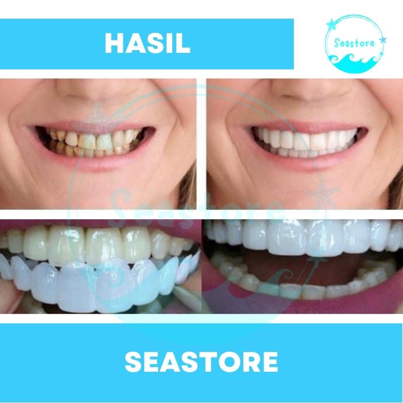 Veneer Vener Gigi Snap On Smile Authentic Perawatan Kesehatan Gigi Palsu Renggang Snapon Smile 1 Set 100% ORI