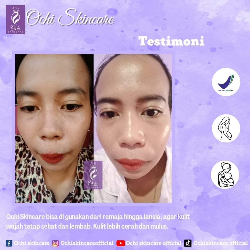 OCHI skincare PLATINUM original paket perawatan premium bpom pemutih wajah aman/SKINCARE WANITA AMAN BPOM