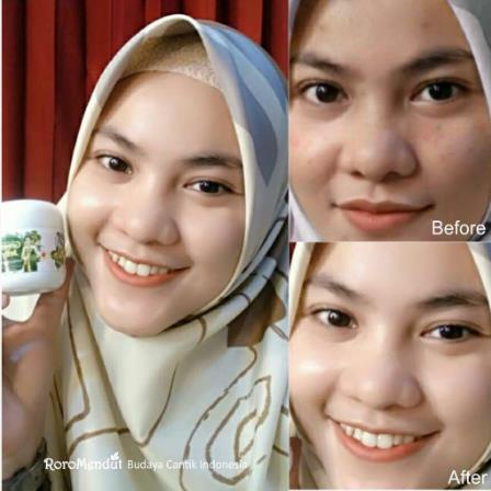 * NCC * Roro Mendut Green Jelly Red Orange Glowing Skincare Booster Day And Night Treatment