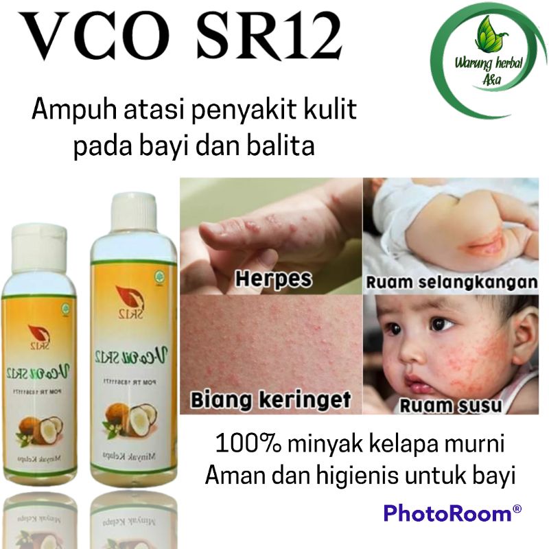 Ruam popok obat kulit merah bayi - vco oil sr12 obat ruam susu ruam popok pada bayi | mengobati aler