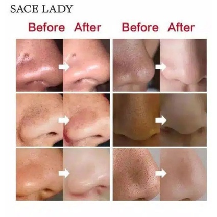 SACE LADY MASKER KOMEDO SACE LADY | PORE PACK NOSE PACK DEEP CLEANSING PORE STRIPS