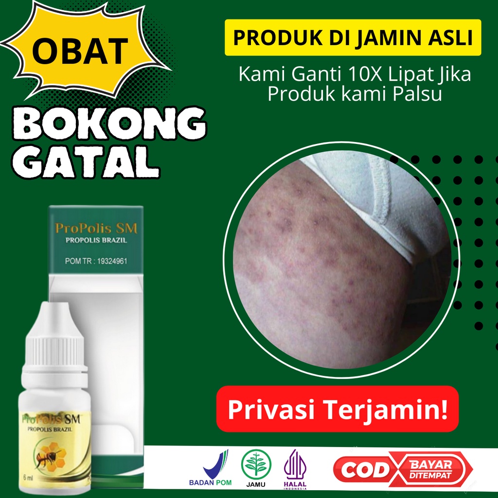 Propolis SM Obat Bokong Gatal Dan Bruntusan - Bokong Burik - Bentol Salep Jerawat Di Pantat - Jamur 
