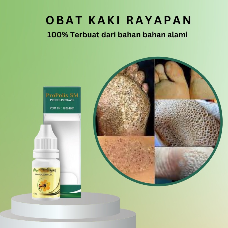 obat penghilang telapak kaki rayapan, Obat telapak kaki bolong bolong, obat herbal telapak kaki raya