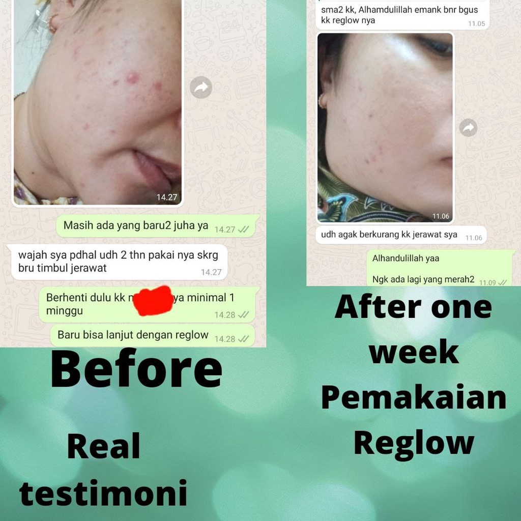 REGLOW TONER 2 IN 1 MICELLAR WATER 100ML PENGHILANG JERAWAT