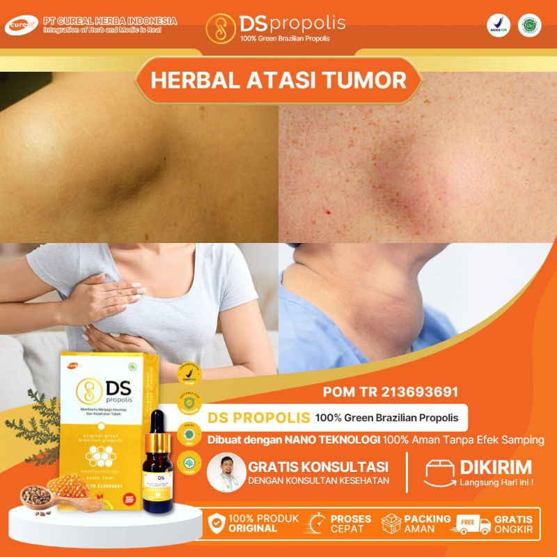 Cureal DS Propolis Herbal Membantu Mengatasi Tumor