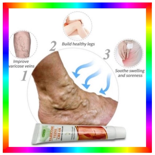 Obat Varikokel Salep Varises Cream Varicose Veins Obat Varises Kemaluan Bengkak Benjolan Buah Zakar 