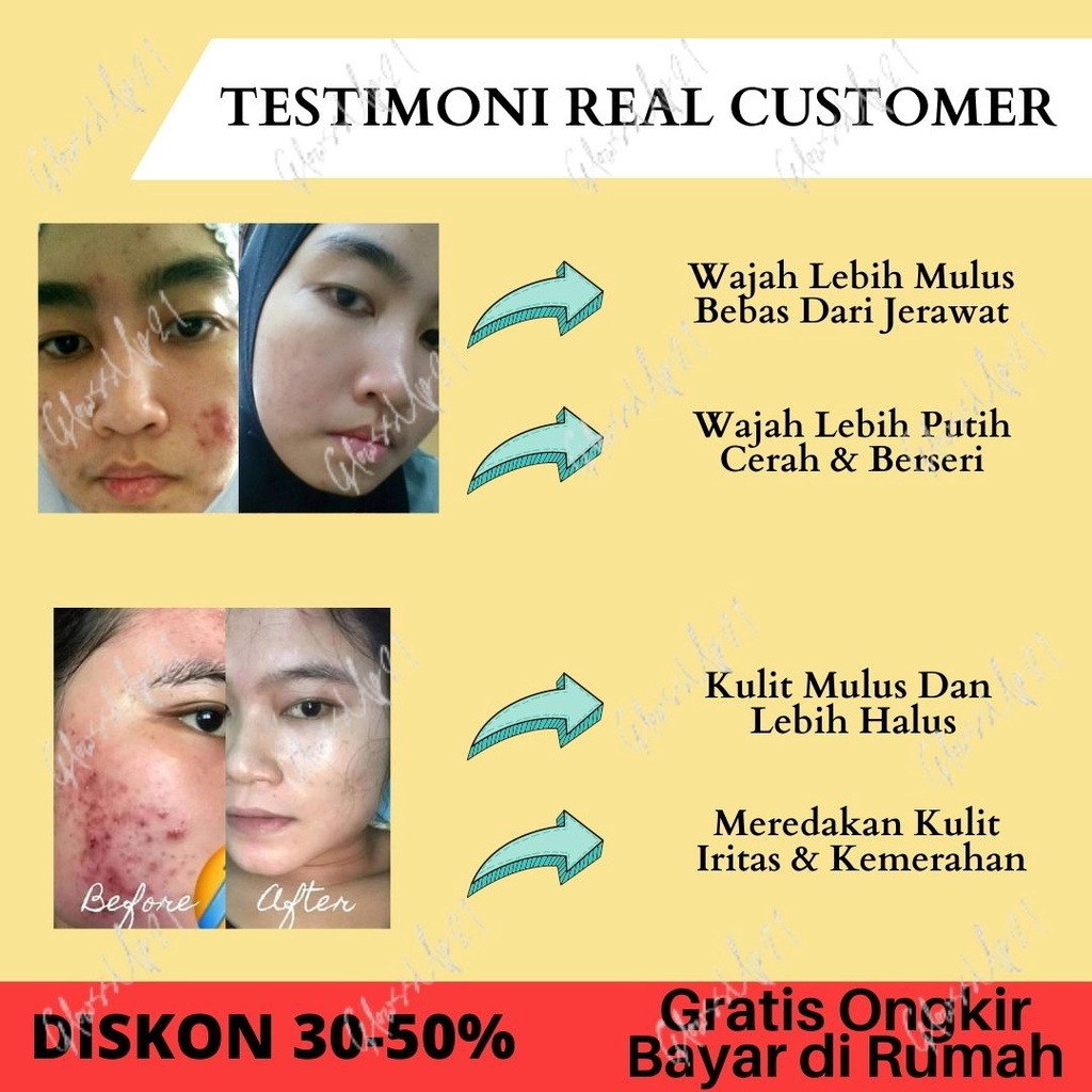 SABUN WAJAH BERJERAWAT DR PURE ACNE CARE BEAUTY BRIGHTENING SOAP BPOM - SABUN JERAWAT DR PURE