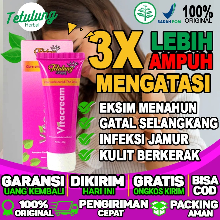 Obat Salep Vitacream Menghilangkan Gatal Pada Kulit Dan Gatal Selangkangan