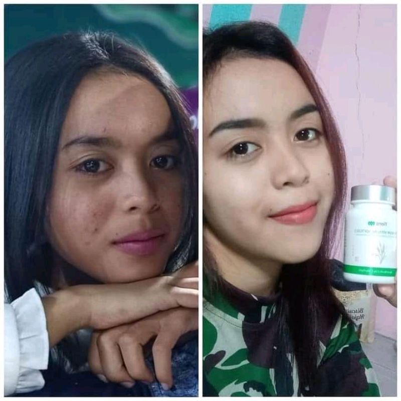 VITALINE SOFGEL PEMUTIH SELURUH BADAN DAN PENGHILANG BEKAS LUKA